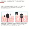 Вакуумный Очиститель Пор Лица и Прибор Для Пилинга 3 Режима Мощности + Функция Вибро Разогрева Кожи Чёрный